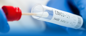 Imagem de um tubo de teste swab para exame de COVID – 19, sob fundo azul e branco. 